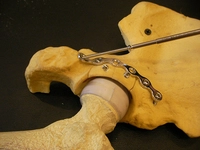 Kalça Kırığı Belirtileri ve Tedavisi